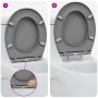 Asiento de Inodoro de Liberación Rápida con Cierre Suave Duroplast Gris by , Toilet and bidet seats - Ref: Foro24-42002347, P...