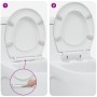 Asiento de Inodoro de Liberación Rápida con Cierre Suave Duroplast Blanco by , Toilet and bidet seats - Ref: Foro24-42002349,...