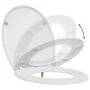 Asiento de Inodoro de Liberación Rápida con Cierre Suave Duroplast Blanco de , Asientos de inodoros y bidés - Ref: Foro24-420...
